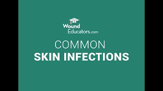 Common Skin Infections  Wound Care for Skin  WoundEducators [upl. by Acinot]