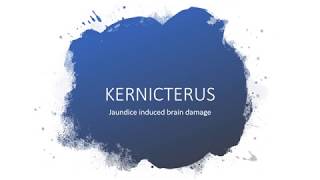 kernicterus brain damage by jaundice [upl. by Sirraf945]