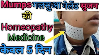 Mumps  गलसुआ  homeopathc medicin for mumps diseases [upl. by Enyr719]