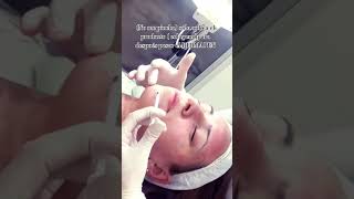 Aplicación del colágeno DERMAPEN FACIAL colageno mi primera vez✨💖 [upl. by Nealy]