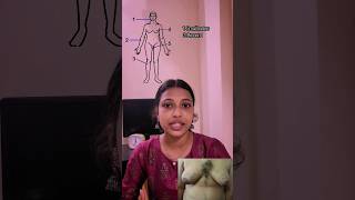 klinefelters syndrome science biology tnpscexam neet neetbiology [upl. by Opportina]