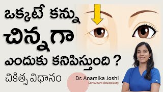 ఒక్కటే కన్ను చిన్నగా ఎందుకు కనిపిస్తుంది  Ptosis telugu  Droopy Eyelid Telugu  Dr Anamika Joshi [upl. by Morrissey]