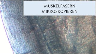 MUSKELZELLEN MIKROSKOPIEREN [upl. by Schober]