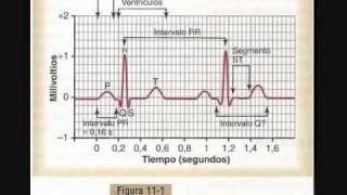 electrocardiogramapiz1wmv [upl. by Edmonda]