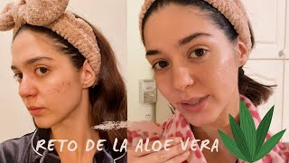 APLICANDO POR 15 DIAS ALOE VERA EN MI CARA  Antes y Después [upl. by Ahsihat]