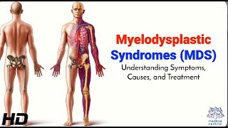 Myelodysplastic Syndromes MDS Symptoms Diagnosis and Treatment [upl. by Annehcu827]