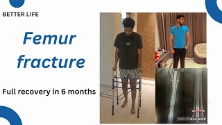 Full femur fracture recovery processself improvement india hope fracture anxiety [upl. by Kaia]