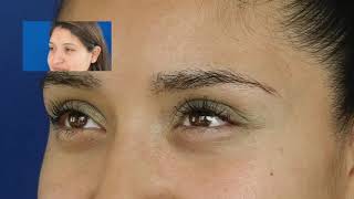 Implante de Cejas Antes y Despues 😎 VIDEO REAL SIN MAQUILLAR EL RESULTADO [upl. by Nnairahs]