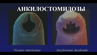 Анкилостомидозы Анкилостомоз Ancylostoma duodenale и Некатороз Necator americanus [upl. by Toogood]