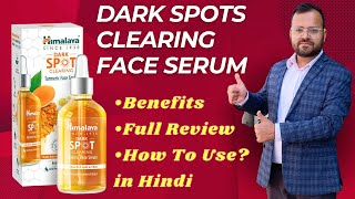 Best Serum For Dark Spots And Acne Scars  Dark Spots On Face Removal  Himalaya Dark Spot Clearing [upl. by Nahtanoj]