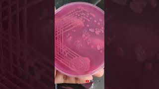 Macconkey agar  culture media  tjbiologist  biology  science  media streaking  medical [upl. by Amikay]