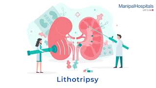 Non Surgical Kidney Stone Treatment Lithotripsy in Delhi  Care Well Medical Centre [upl. by Sikram]