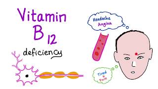 Vitamin B12 Cobalamin Deficiency  Causes Symptoms Diagnosis amp Management  Hematology Series [upl. by Blane]