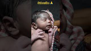 First Few Seconds ago Birth of NEWBORN BABY cute firstlook Newborn baby viral [upl. by Beesley]