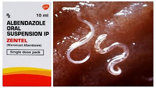 Zentel Oral Suspension  Albendazole  बच्चों में कृमि और चुन्ना काटने की समस्या को ठीक करने की दवा [upl. by Nosidam]