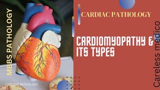 CARDIAC PATHOLOGY Cardiomyopathy amp its typeslecture18mbbs pathology pathoma robbins cvs [upl. by Ringsmuth321]