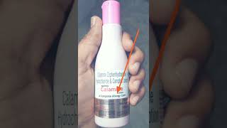 calamine lotion uses  complete allergy treatment [upl. by Ahter767]