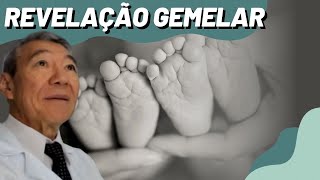 REVELAÇÃO DE GEMELAR  16 semanas [upl. by Falcone226]