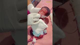 After Birth Newborn Baby immediate carenewbornbabybabybornnewbornmedical [upl. by Haerr]