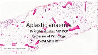 Aplastic anaemia  Pancytopenia  Haematology  RATS  Dr GSS  SRM  MBBS  BDS UQs [upl. by Acinorev]