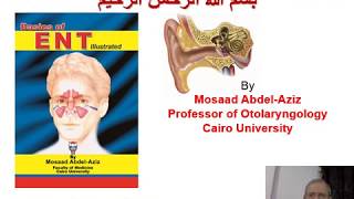 Ear 4 Mosaad AbdelAziz Chronic Suppurative Otitis Media [upl. by Pine]