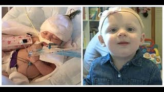 Baby critically injured in alleged daycare abuse benefit planned to celebrate miraculous recovery [upl. by Dearr579]