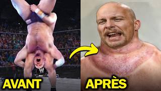 Les Blessures Qui Ont Changé De Façon Permanente Le Corps Des Catcheurs De La WWE [upl. by Yesteb]