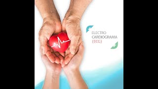 ECG Holter 24 hrs Extrasistoles Cardiología Vallarta [upl. by Enia103]