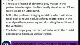 Subependymal graymatter heterotopia periventricular nodular heterotopia febrile seizures [upl. by Eitsrik]