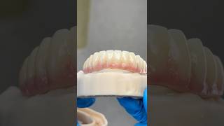 Lower PMMA Provisional EnvisiontecMain envisiontec lsk121shorts dentist teethsmile [upl. by Egidius613]