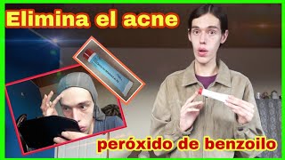 Como usar el Peróxido de Benzoilo para Quitar el Acne [upl. by Lananna822]