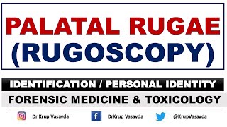 Rugoscopy  Palatal Rugae  Identification  Dr Krup Vasavda [upl. by Jacy]