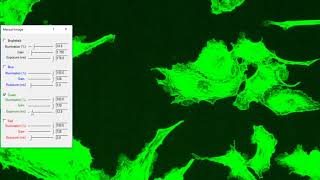 Low Exposure Fluorescence Imaging shows High Sensitivity Microscopy [upl. by Aklog]