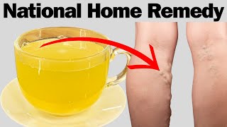 National Home Remedy For Varicose Veins and Poor Circulation [upl. by Ahsiekam661]