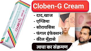 Cloben G Cream  Cloben G Cream Uses in Hindi  त्वचा का संक्रमण  fungal infection [upl. by Yelac]