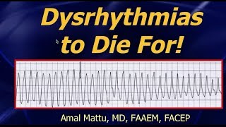 Dysrhythmias workshop [upl. by Edyaw]