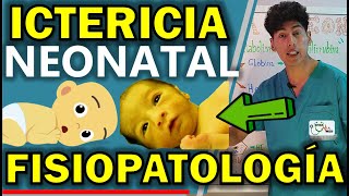 ICTERICIA NEONATAL FISIOPATOLOGÍA  GuiaMed [upl. by Adnoma]