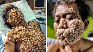 The MOST Unusual People With Very Bizarre Skin Conditions [upl. by Betsey]