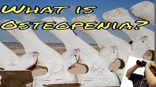 What is Osteopenia A brief description of what osteopenia and osteoporosis are [upl. by Aramoj258]