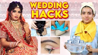 7 QUICK amp EASY Life Saving WEDDING Hacks  Anaysa [upl. by Ulyram]