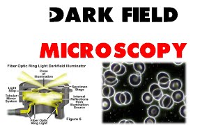 Dark field microscopy [upl. by Nnylirak]