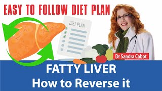 How to Reverse Fatty Liver Disease Naturally  Easy to Follow Diet Plan  DR SANDRA CABOT [upl. by Aiblis]