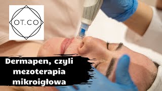 Dermapen czyli mezoterapia mikroigłowa kosmetolog odpowiada  OTCO Clinic [upl. by Notsahc]