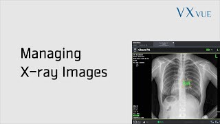 VXvue Quick Guide 04 Managing Tools for Xray Images [upl. by Oisangi]