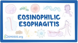 Eosinophilic esophagitis NORD [upl. by Oibesue]