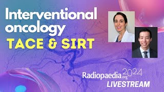 Interventional oncology TACE amp SIRT with Heather Moriarty [upl. by Nallid]