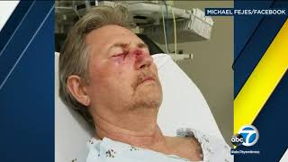 Mans eyesight damaged in random paintball attack  ABC7 [upl. by Perdita425]