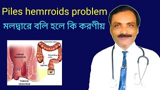 Piles hemorrhoids problem  পাইলস বা অর্শ রোগে মলদ্বারে বলি হলে কি করণীয়  Dr SP Goswami [upl. by Imailiv292]