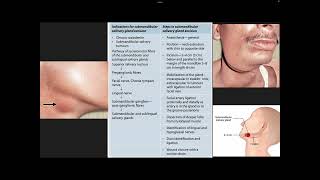 Salivary glands part 2 [upl. by Donall]