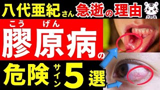 【放置厳禁】知らないと後悔する「膠原病」の初期症状。八代亜紀さんが急逝した理由【間質性肺炎】とは？初期の危険サインと膠原病の初期症状を徹底解説！【健康】【予防医学】【医学】【本の要約】 [upl. by Fitalludba730]